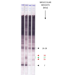 ECHINOCOCCUS Western Blot IgG ECHINOCOCCUS Western Blot IgG