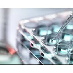 Bio-Speedy® Hepatitis A/E RT-qPCR Kit