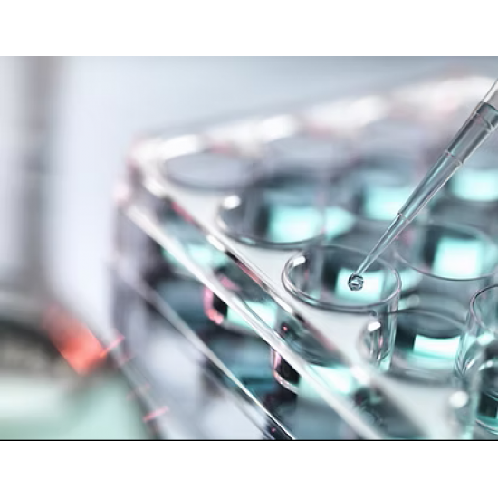 Bio-Speedy® Norovirus (GI/GII) RT-qPCR Kit Bio-Speedy® Norovirus (GI/GII) RT-qPCR Kit